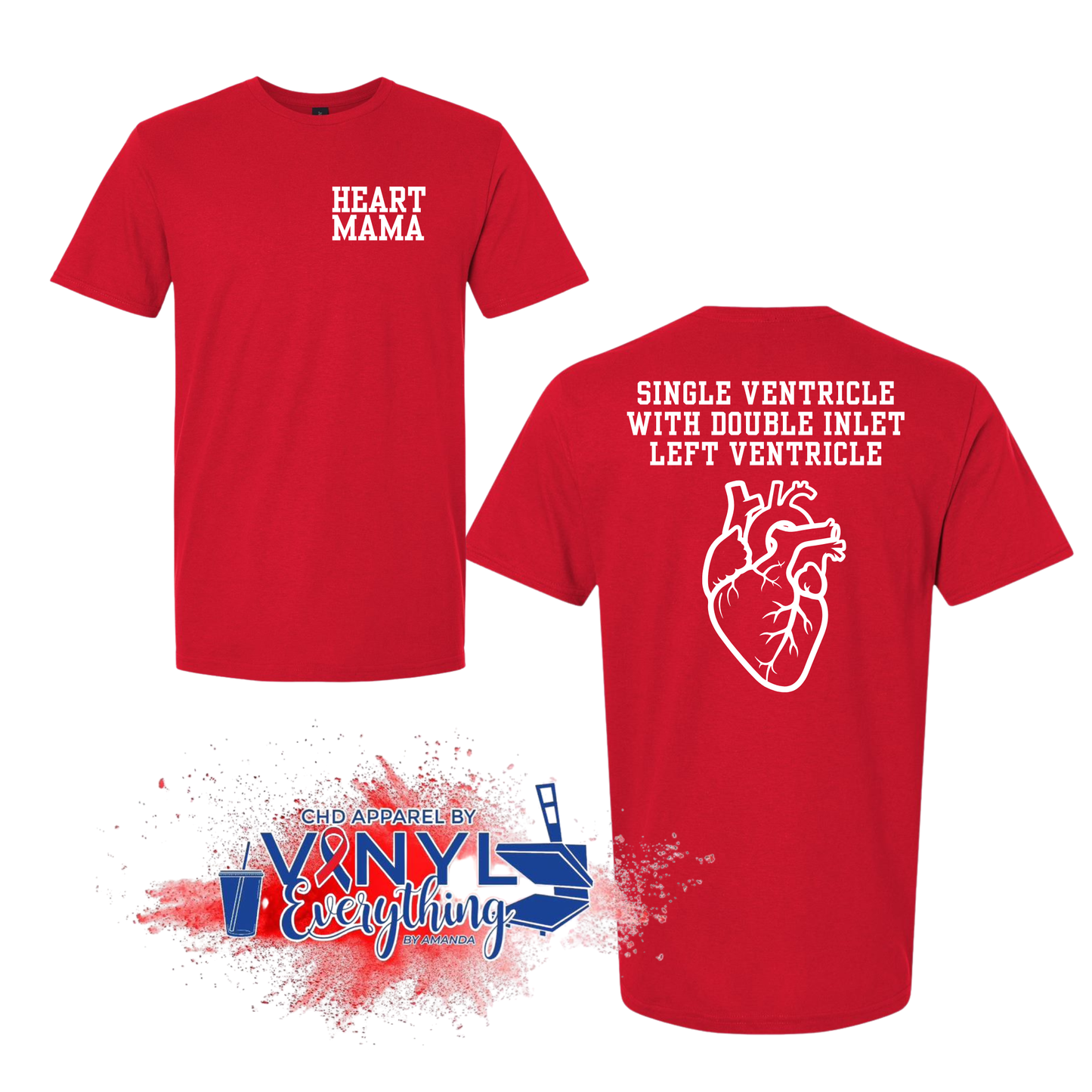 CUSTOM: Single Ventricle with Double Inlet Left Ventricle