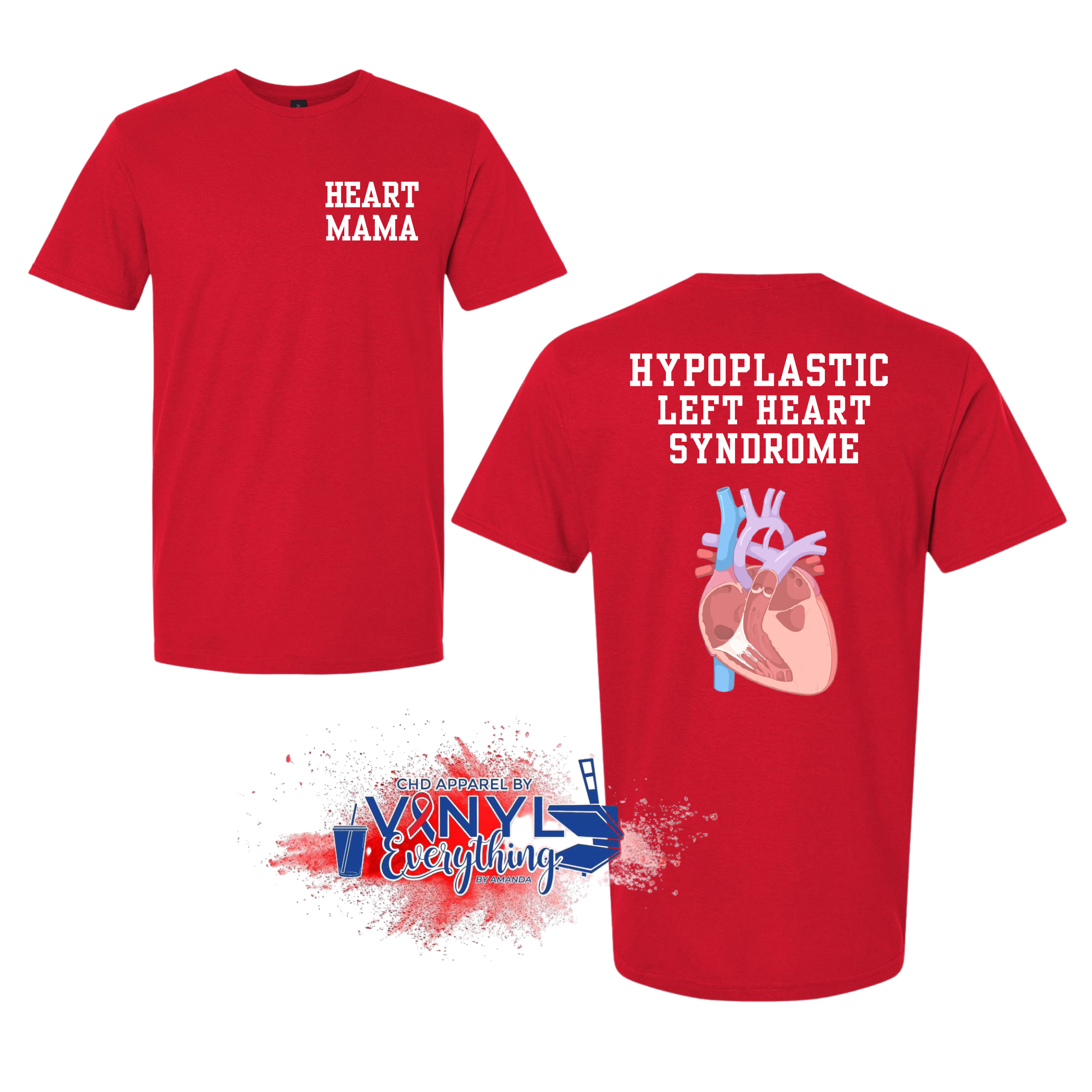 CUSTOM: HLHS – Impact Apparel by Amanda